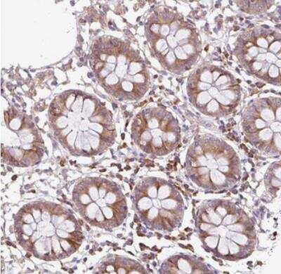 Immunohistochemistry-Paraffin: RPS23 Antibody [NBP2-30412]