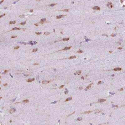 Immunohistochemistry-Paraffin: RPS23 Antibody [NBP2-30412]