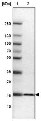 Western Blot: RPS23 Antibody [NBP2-30412]