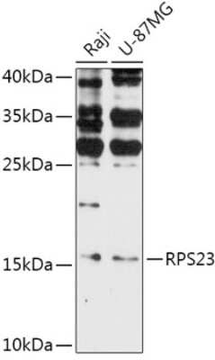 Western Blot: RPS23 AntibodyAzide and BSA Free [NBP2-94136]