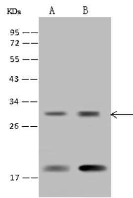 Western Blot: RPS23 Antibody [NBP2-97621]