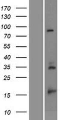 Western Blot: RPS23 Overexpression Lysate [NBP2-08647]