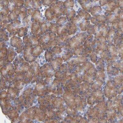 Immunohistochemistry-Paraffin: RPS24 Antibody [NBP1-80803]