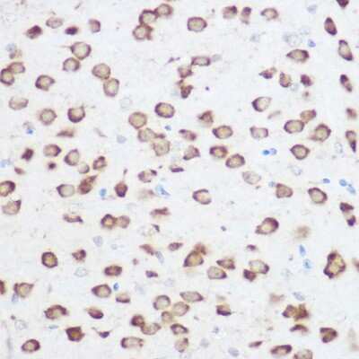 Immunohistochemistry-Paraffin: RPS24 Antibody - Azide and BSA Free [NBP2-93809]