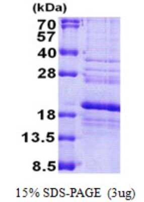 SDS-PAGE: Recombinant Human RPS24 His Protein [NBP2-23435]