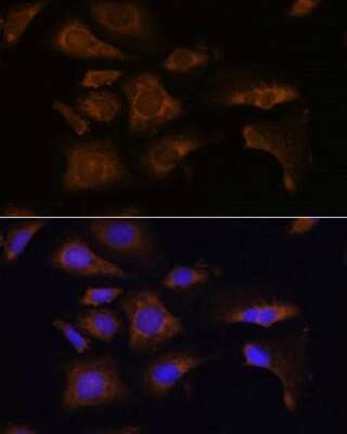 Immunocytochemistry/ Immunofluorescence: RPS25 Antibody - Azide and BSA Free [NBP2-93936]