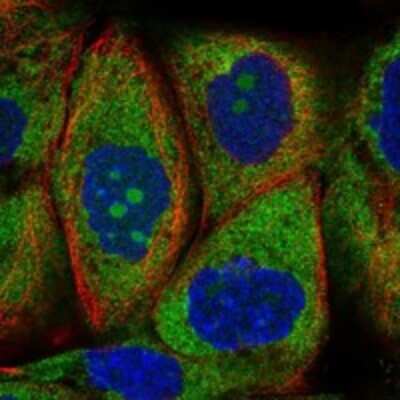 Immunocytochemistry/ Immunofluorescence: RPS25 Antibody [NBP3-17305]