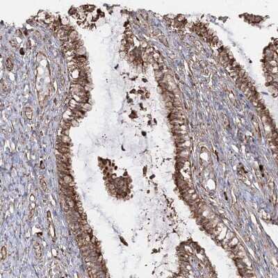 Immunohistochemistry-Paraffin: RPS25 Antibody [NBP1-80802]