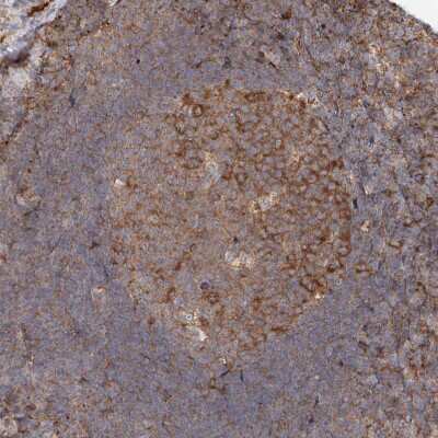 Immunohistochemistry-Paraffin: RPS25 Antibody [NBP1-80802]