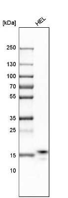 Western Blot: RPS25 Antibody [NBP1-80802]