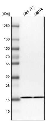 Western Blot: RPS25 Antibody [NBP1-80802]