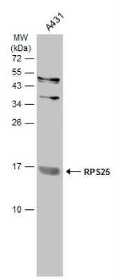 Western Blot: RPS25 Antibody [NBP2-43650]