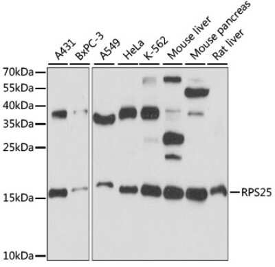 Western Blot: RPS25 AntibodyAzide and BSA Free [NBP2-93936]