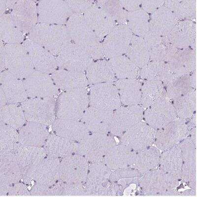 Immunohistochemistry-Paraffin: RPS26 Antibody [NBP1-92352]