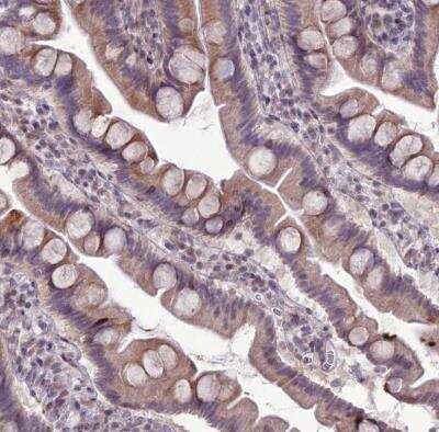 Immunohistochemistry-Paraffin: RPS26 Antibody [NBP1-92352]