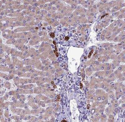 Immunohistochemistry-Paraffin: RPS26 Antibody [NBP1-92352]