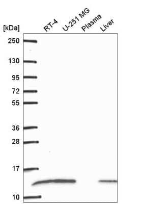 Western Blot: RPS27L Antibody [NBP2-57624]