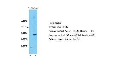 Western Blot: RPS28 Antibody [NBP2-85673]