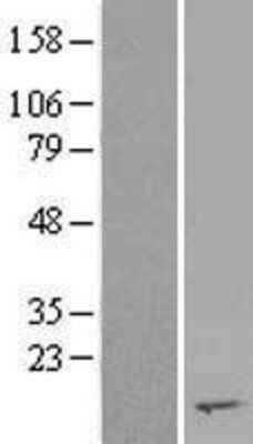 Western Blot: RPS2P45 Overexpression Lysate [NBL1-10751]