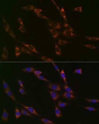 Immunocytochemistry/ Immunofluorescence: RPS3 Antibody (3X2M4) [NBP3-16496]
