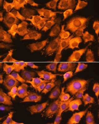 Immunocytochemistry/ Immunofluorescence: RPS3 Antibody - BSA Free [NBP2-93895]