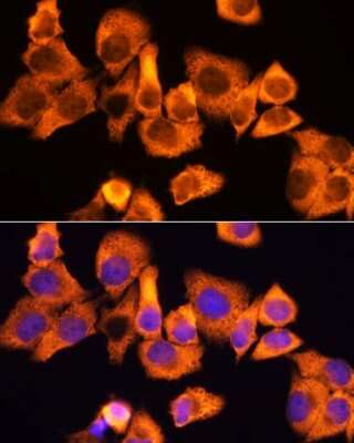 Immunocytochemistry/ Immunofluorescence: RPS3 Antibody - BSA Free [NBP2-93895]