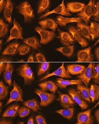 Immunocytochemistry/ Immunofluorescence: RPS3 Antibody - BSA Free [NBP2-93895]