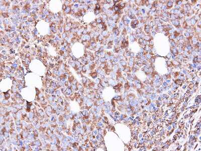 Immunohistochemistry-Paraffin: RPS3 Antibody [NBP1-33691]