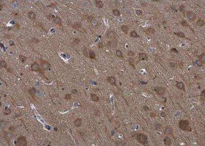 Immunohistochemistry-Paraffin: RPS3 Antibody [NBP1-33691]