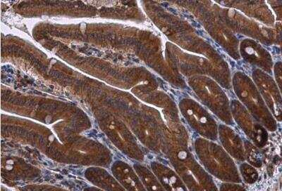 Immunohistochemistry-Paraffin: RPS3 Antibody [NBP1-33691]