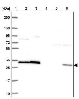 Western Blot: RPS3 Antibody [NBP2-38024]