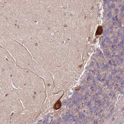 Immunohistochemistry-Paraffin: RPS3A Antibody [NBP2-13264]
