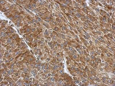 Immunohistochemistry-Paraffin: RPS3A Antibody [NBP2-20225]