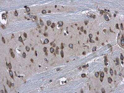 Immunohistochemistry-Paraffin: RPS3A Antibody [NBP2-20225]