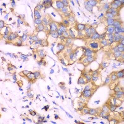 Immunohistochemistry-Paraffin: RPS3A Antibody - BSA Free [NBP2-94503]