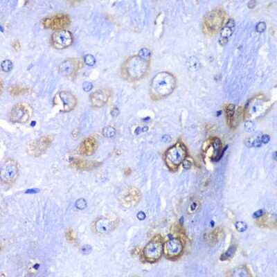 Immunohistochemistry-Paraffin: RPS3A Antibody - BSA Free [NBP2-94503]