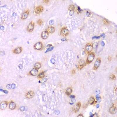 Immunohistochemistry-Paraffin: RPS3A Antibody - BSA Free [NBP2-94503]