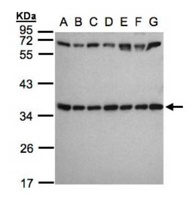 Western Blot: RPS3A Antibody [NBP1-31598]