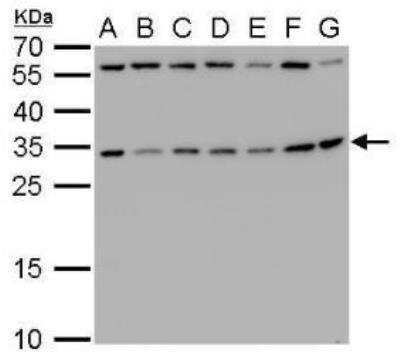 Western Blot: RPS3A Antibody [NBP1-31598]