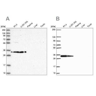 Western Blot: RPS3A Antibody [NBP2-13264]