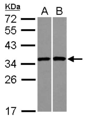 Western Blot: RPS3A Antibody [NBP2-20225]