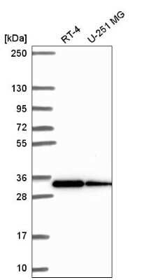 Western Blot: RPS3A Antibody [NBP2-55339]