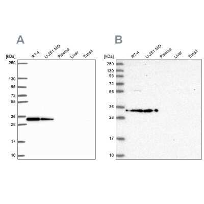 Western Blot: RPS3A Antibody [NBP2-55339]