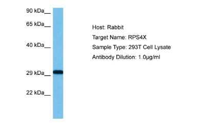 Western Blot: RPS4X Antibody [NBP2-83474]