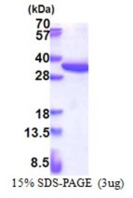 SDS-PAGE: Recombinant Human RPS4X His Protein [NBP2-23436]