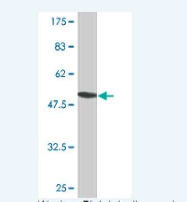 Western Blot: RPS5 Antibody (3A5) [H00006193-M10]