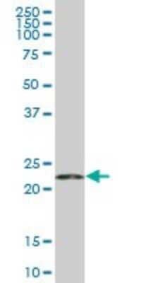 Western Blot: RPS5 Antibody (3G3) [H00006193-M01]