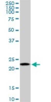 Western Blot: RPS5 Antibody (3G3) [H00006193-M01]