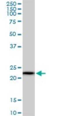 Western Blot: RPS5 Antibody (3G3) [H00006193-M01]