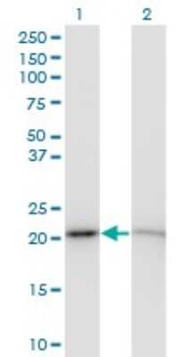 Western Blot: RPS5 Antibody (3G3) [H00006193-M01]